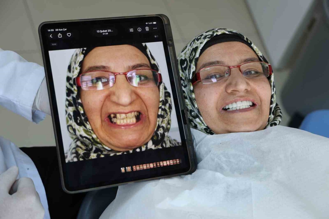 DİŞ TEDAVİSİ GÖREN FATMA HİZMETLİ OKUMUŞ, "KLİNİK BİR VAKAYDIM, AYNAYA BAKAMAYACAK HALE...