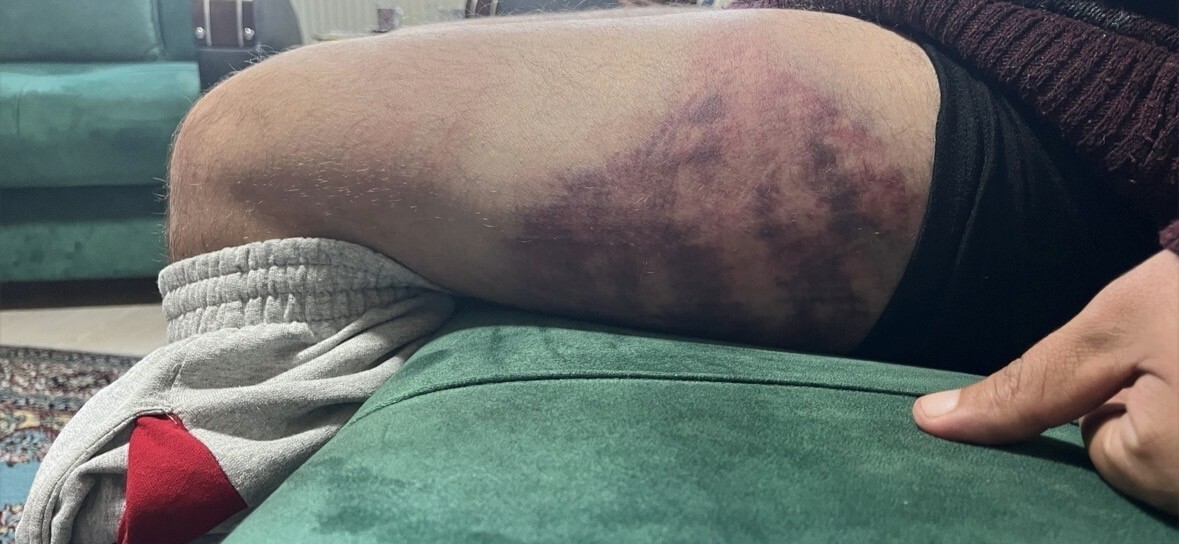 KOCAELİ'NİN İZMİT İLÇESİNDE 4 GÜN ÖNCE ODUNLUĞA BAKTIĞI GEREKÇESİYLE YÜZDE 85 ORANINDA OTİZMLİ...