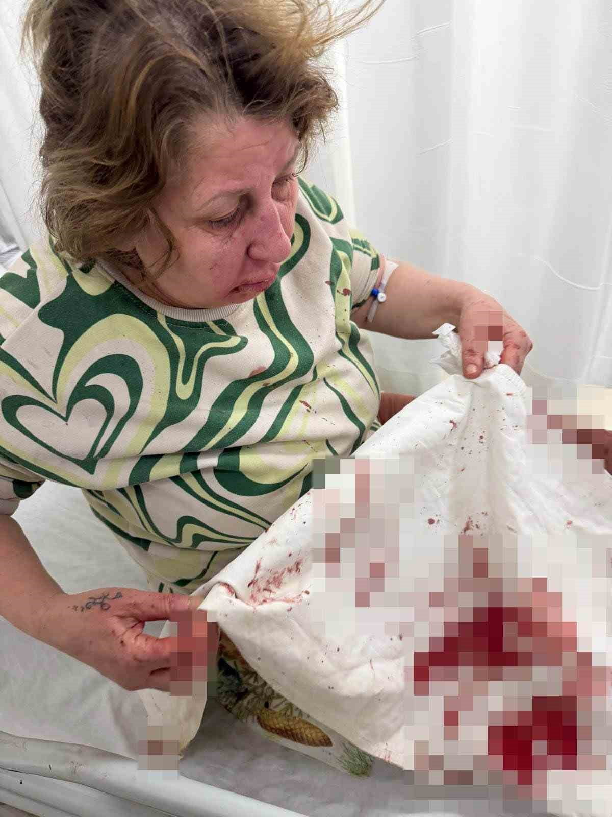 DENİZLİ’NİN SARAYKÖY İLÇESİNDE, GÜRÜLTÜ NEDENİYLE YAŞANAN KOMŞU TARTIŞMASI ŞİDDETLE SONUÇLANDI....