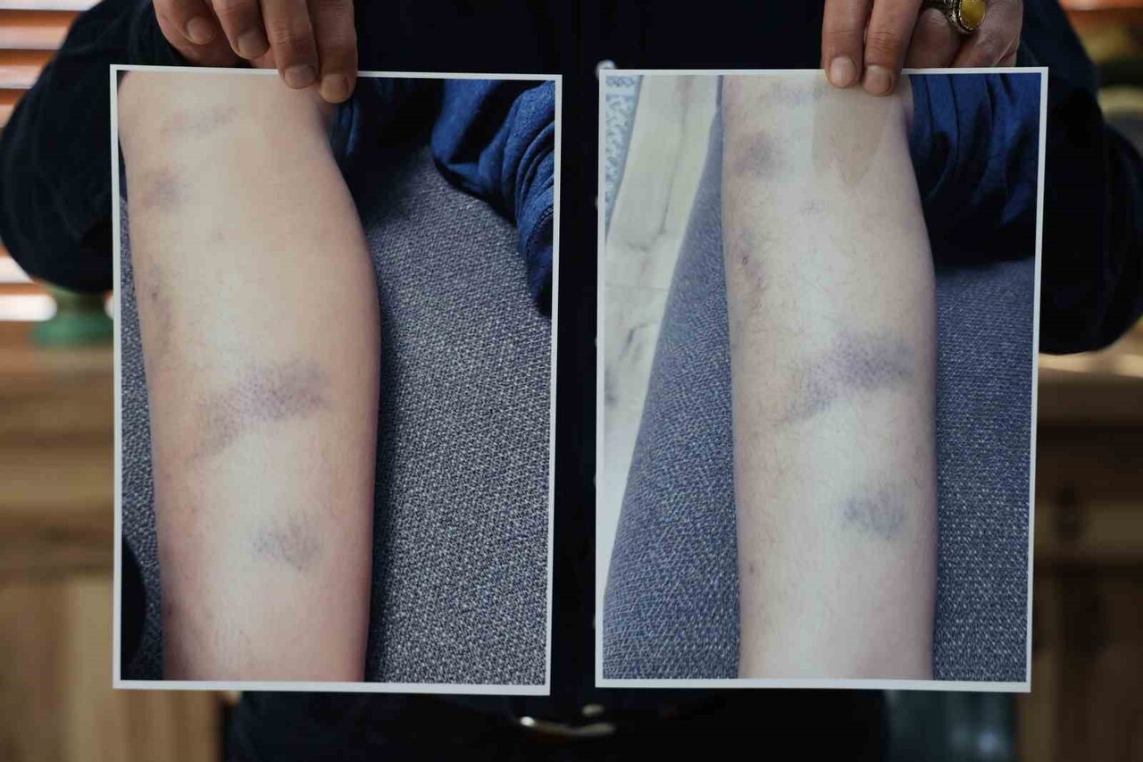 DİYARBAKIR’DA ÖZEL BİR OKULDA 8 YAŞINDAKİ ÇOCUĞUN DARP EDİLDİĞİ İDDİA EDİLDİ. OKUL YÖNETİMİ...