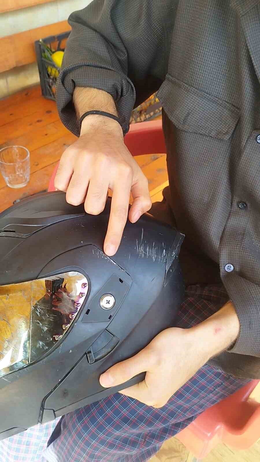 KAZADA KASKI DARBE ALAN GENÇ SÜRÜCÜ, "POLİSLER KASK KONUSUNDA SONUNA KADAR HAKLIYMIŞ" DİYEREK...