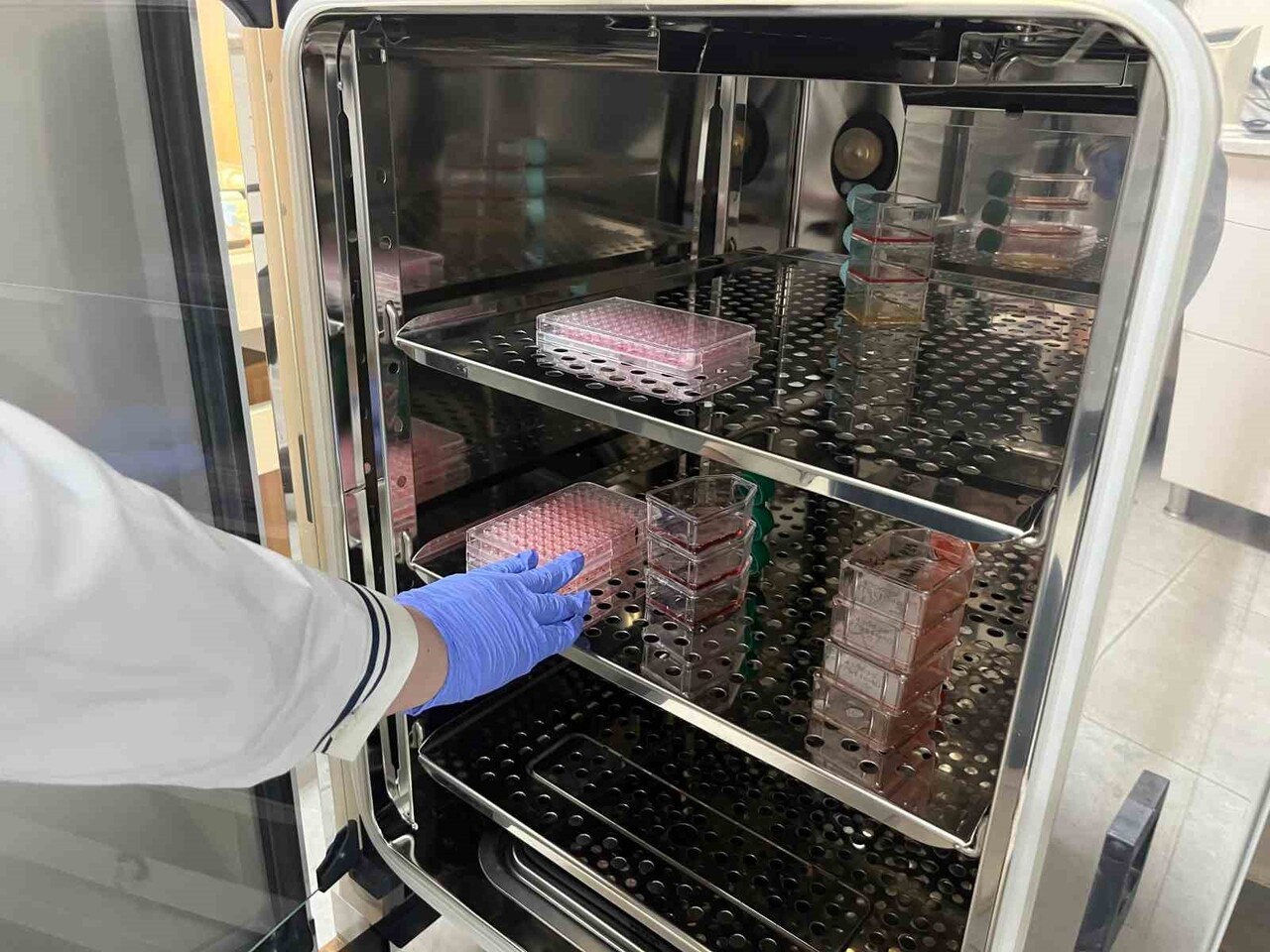 PARKİNSON HASTALIĞINDA BAĞIRSAK VE BEYİN ARASINDAKİ İLETİŞİMİN NASIL BOZULDUĞUNU ORTAYA ÇIKARMAK...