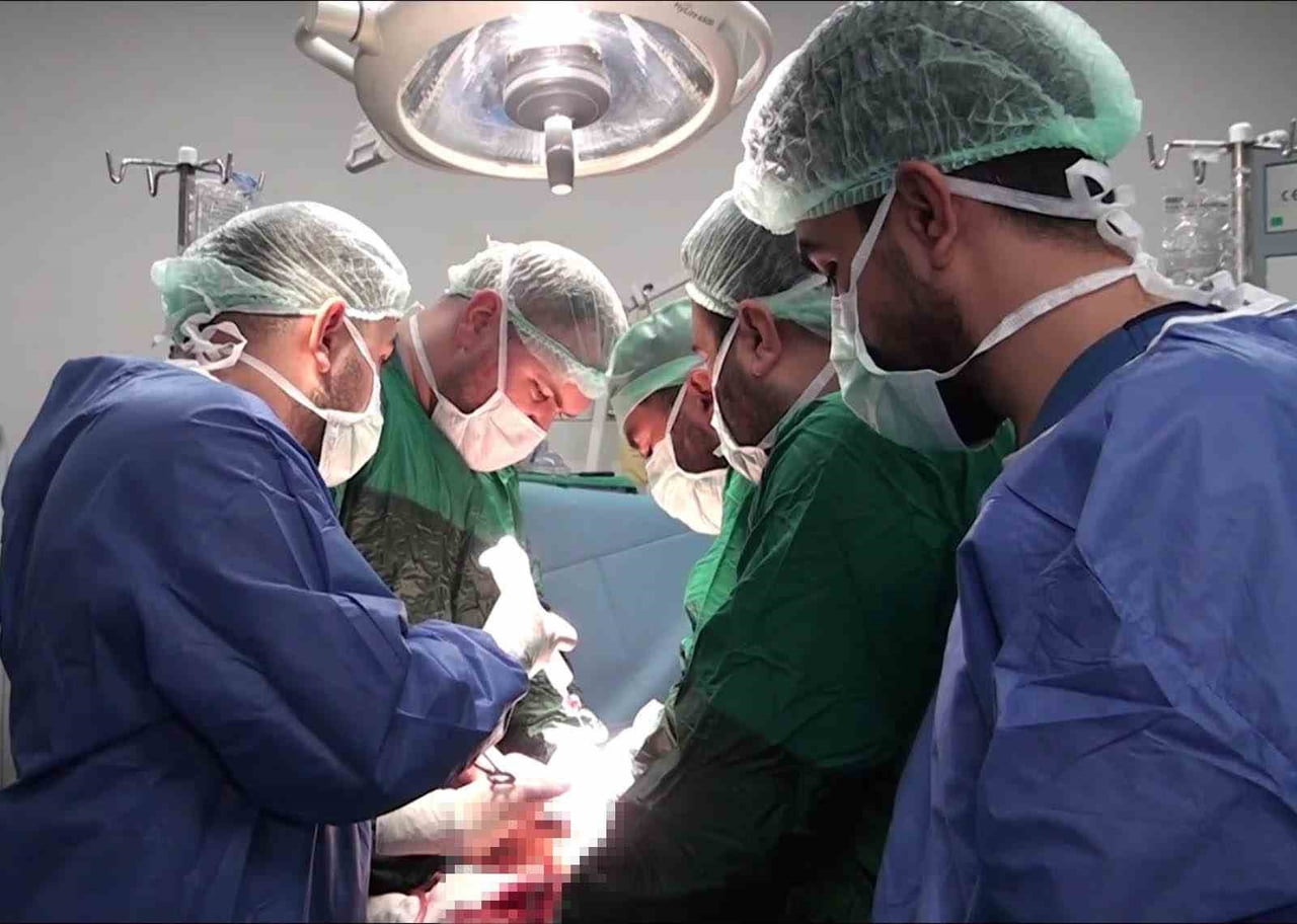 ŞANLIURFA’DA 25 SANTİMETRELİK DEV KİST AMELİYATLA ALINDI