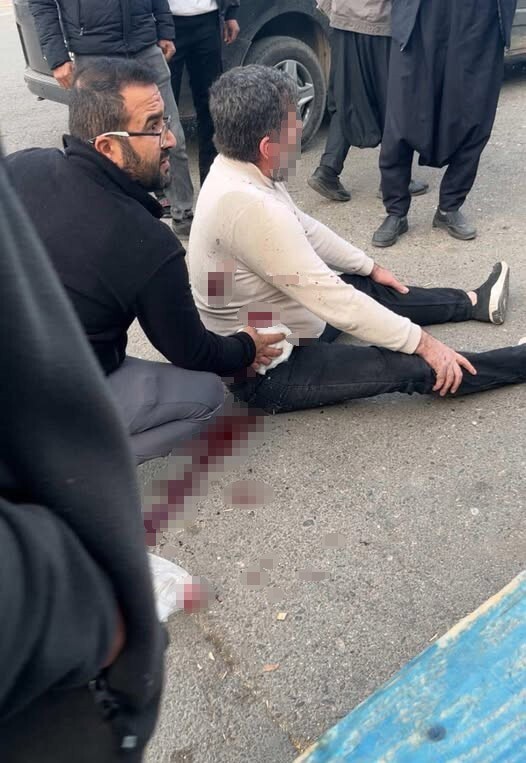 ŞANLIURFA’DA BIÇAKLI KAVGA: 1 YARALI