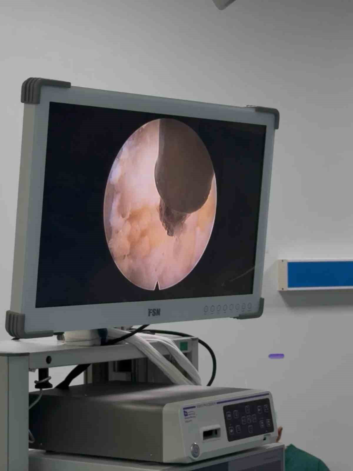 ADÜ HASTANESİ’NDE İLK KEZ UYGULANMAYA BAŞLADI