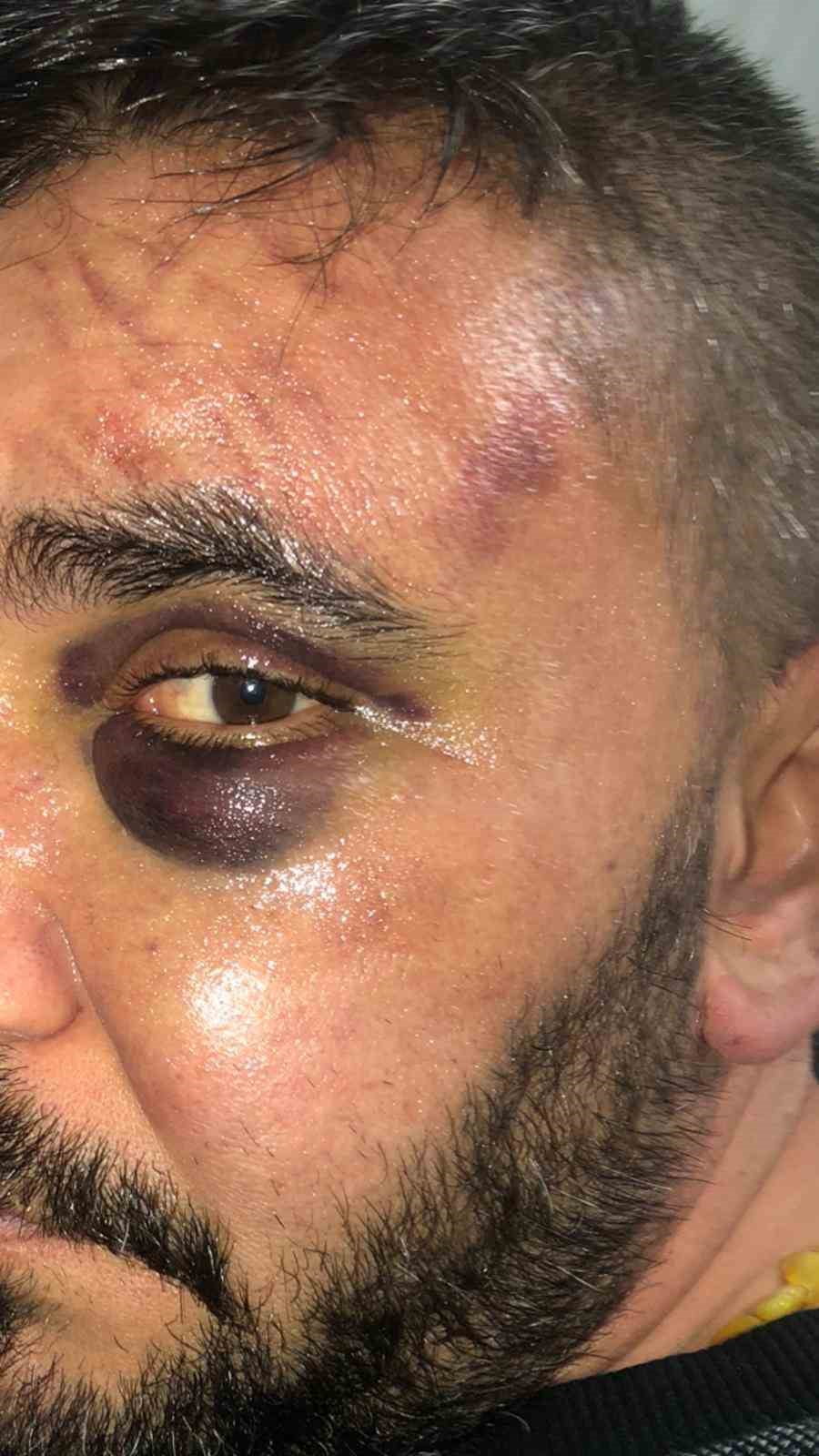 AFYONKARAHİSAR'DA DÜKKANINI BASAN 3 KİŞİ TARAFINDAN ÖLDÜRESİYE DARP EDİLEN İŞ YERİ SAHİBİ BİR...