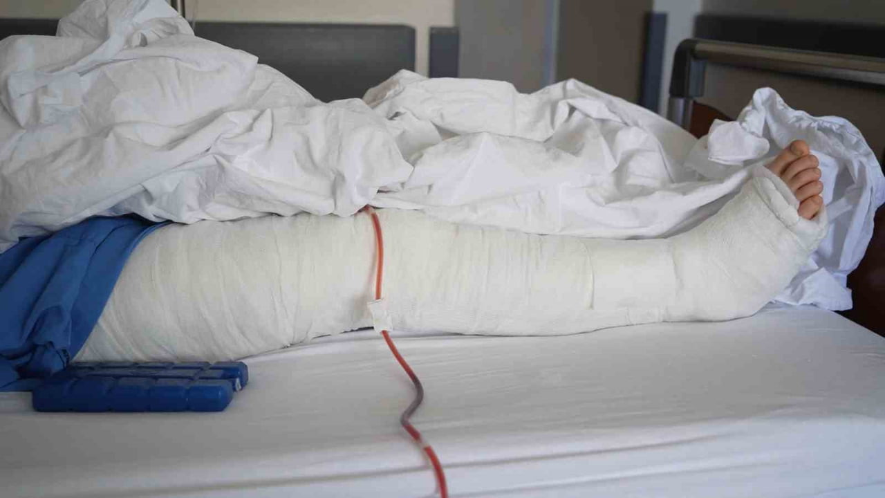 AYTUNA YAZICI'NIN KALÇA KEMİĞİ KIRILDI