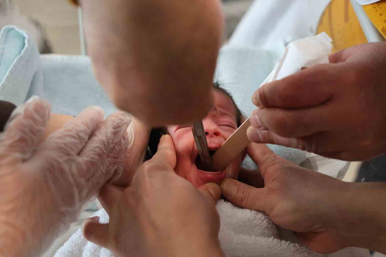DOĞUŞTAN YEMEK BORUSU OLMAYAN BEBEK DOĞUMUNUN 4'ÜNCÜ GÜNÜNDE YAPILAN BAŞARILI AMELİYAT İLE...