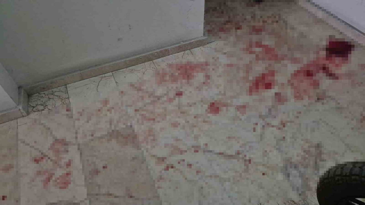 ESKİŞEHİR'DE BİR ŞAHSIN KAVGA ESNASINDA BIÇAKLAYARAK AĞIR YARALADIĞI 50 YAŞINDAKİ ÜVEY BABASI...