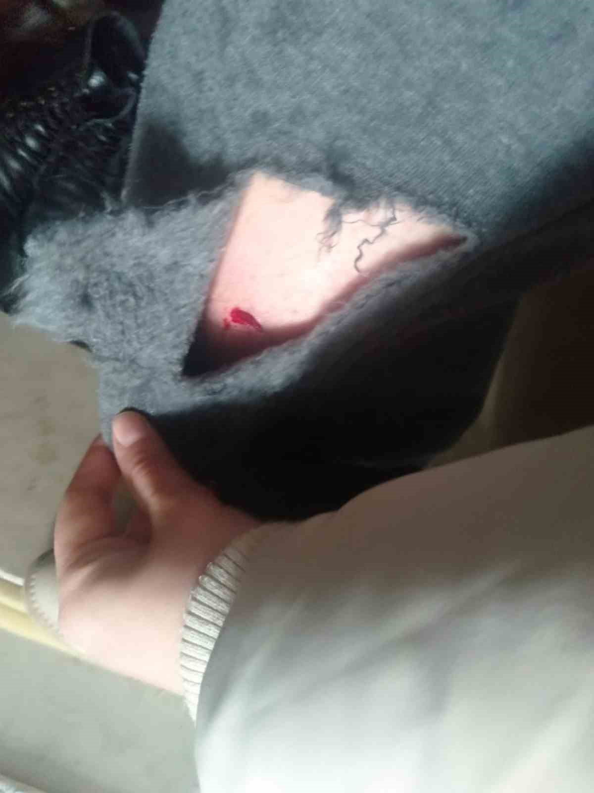 KAYSERİ’NİN TOMARZA İLÇESİNDE BAŞI BOŞ SOKAK KÖPEĞİ BİR KIZ ÇOCUĞUNA SALDIRARAK, BACAĞINDAN...