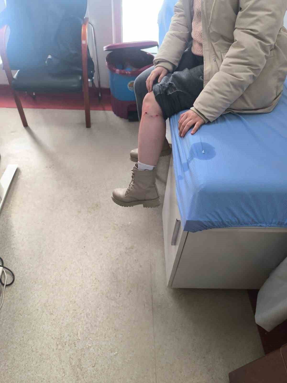 KAYSERİ’NİN TOMARZA İLÇESİNDE BAŞI BOŞ SOKAK KÖPEĞİ BİR KIZ ÇOCUĞUNA SALDIRARAK, BACAĞINDAN...