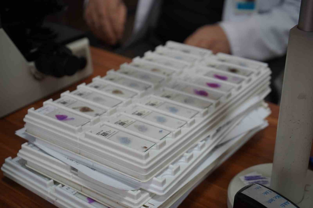 SAKARYA EĞİTİM VE ARAŞTIRMA HASTANESİ PATOLOJİ BÖLÜMÜ ÖĞRETİM ÜYESİ PROF. DR. FAHRİ YILMAZ...